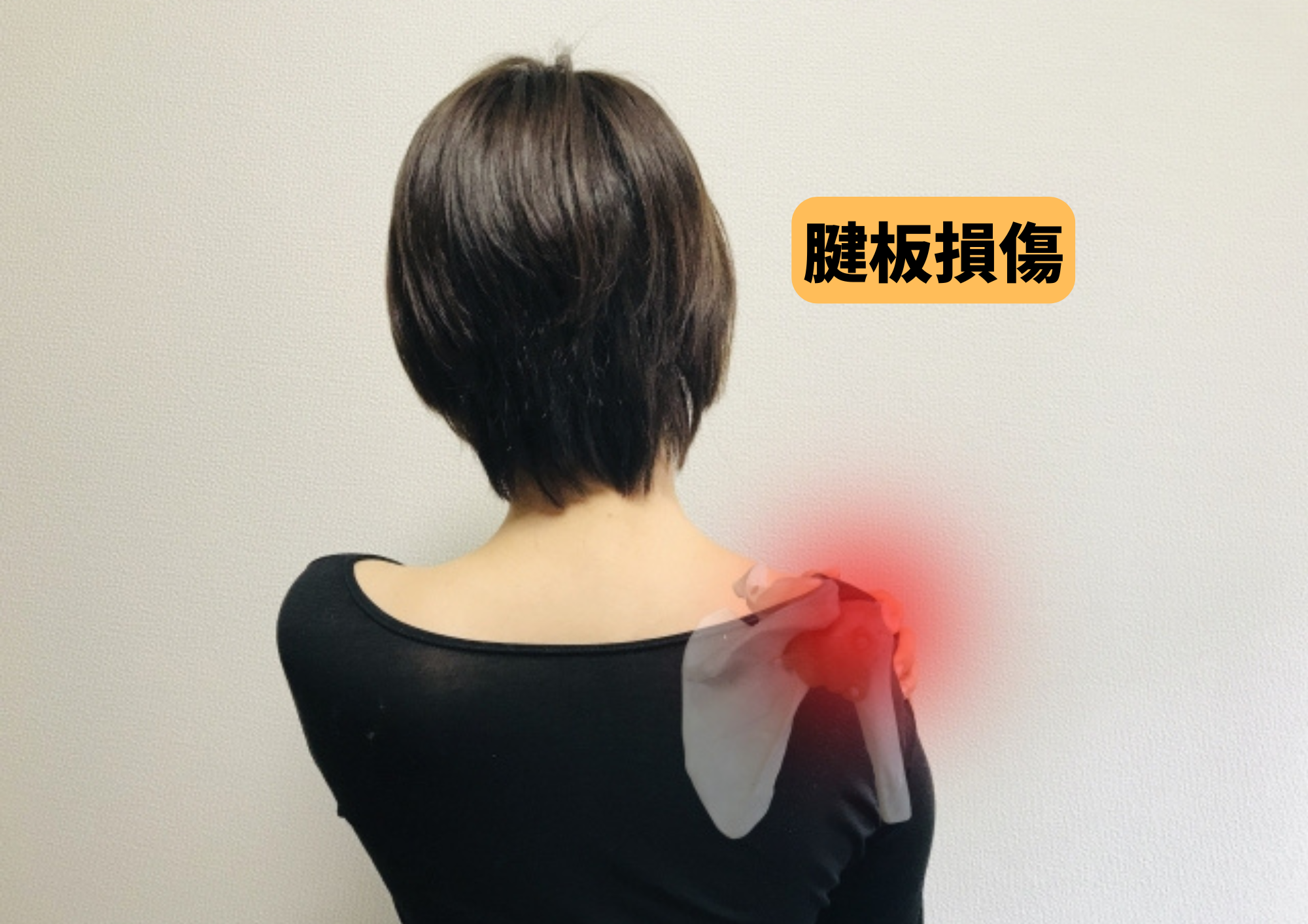 肩の腱板損傷による痛み・動かしにくさ｜長崎市ひなた整骨院