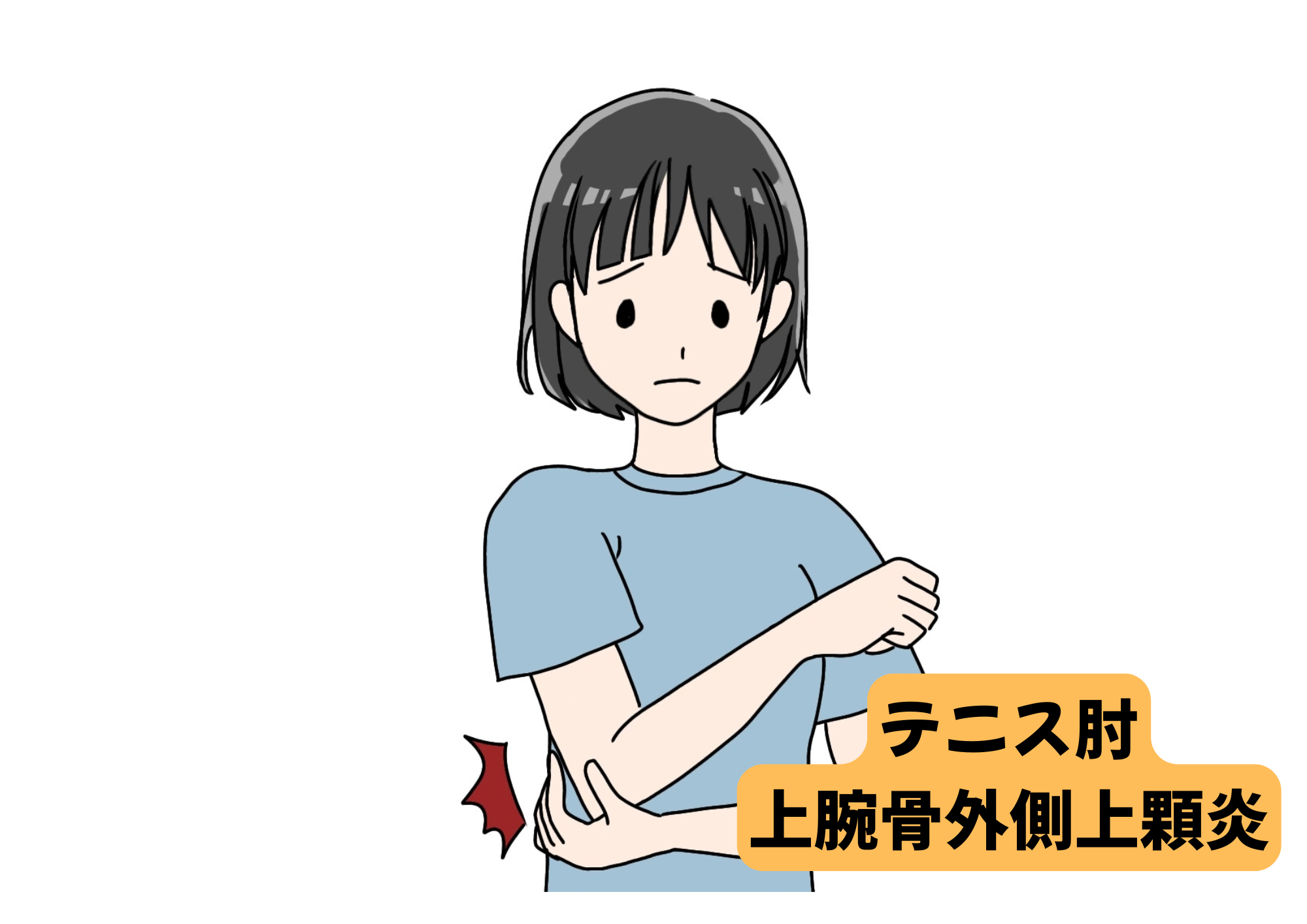 長崎市のテニス肘・上腕骨外側上顆炎｜肘の外側の痛みならひなた整骨院